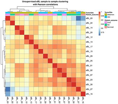 Human and Epstein-Barr Virus miRNA Profiling as Predictive Biomarkers for Endemic Burkitt Lymphoma